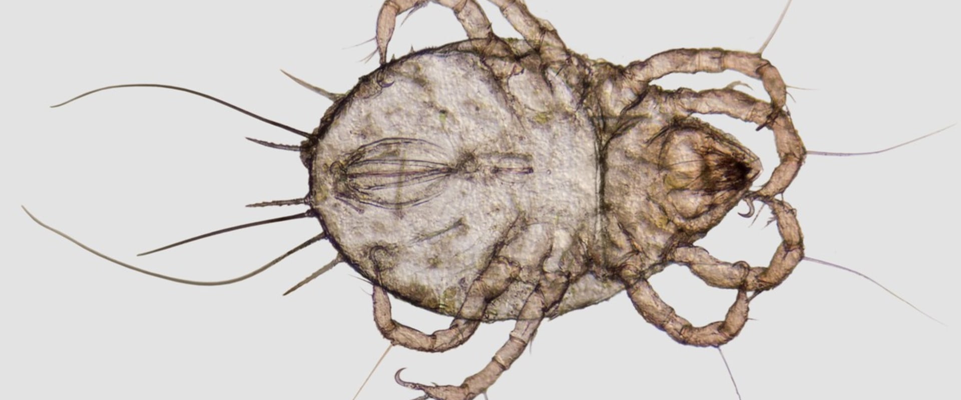 How to Get Rid of Dust Mites Chemical Treatments and Home Remedies