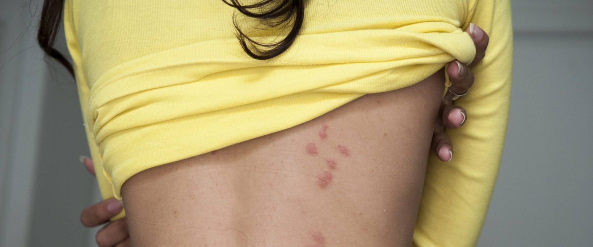 Signs of a Dust Mite Infestation in Your Home How to Identify and Take